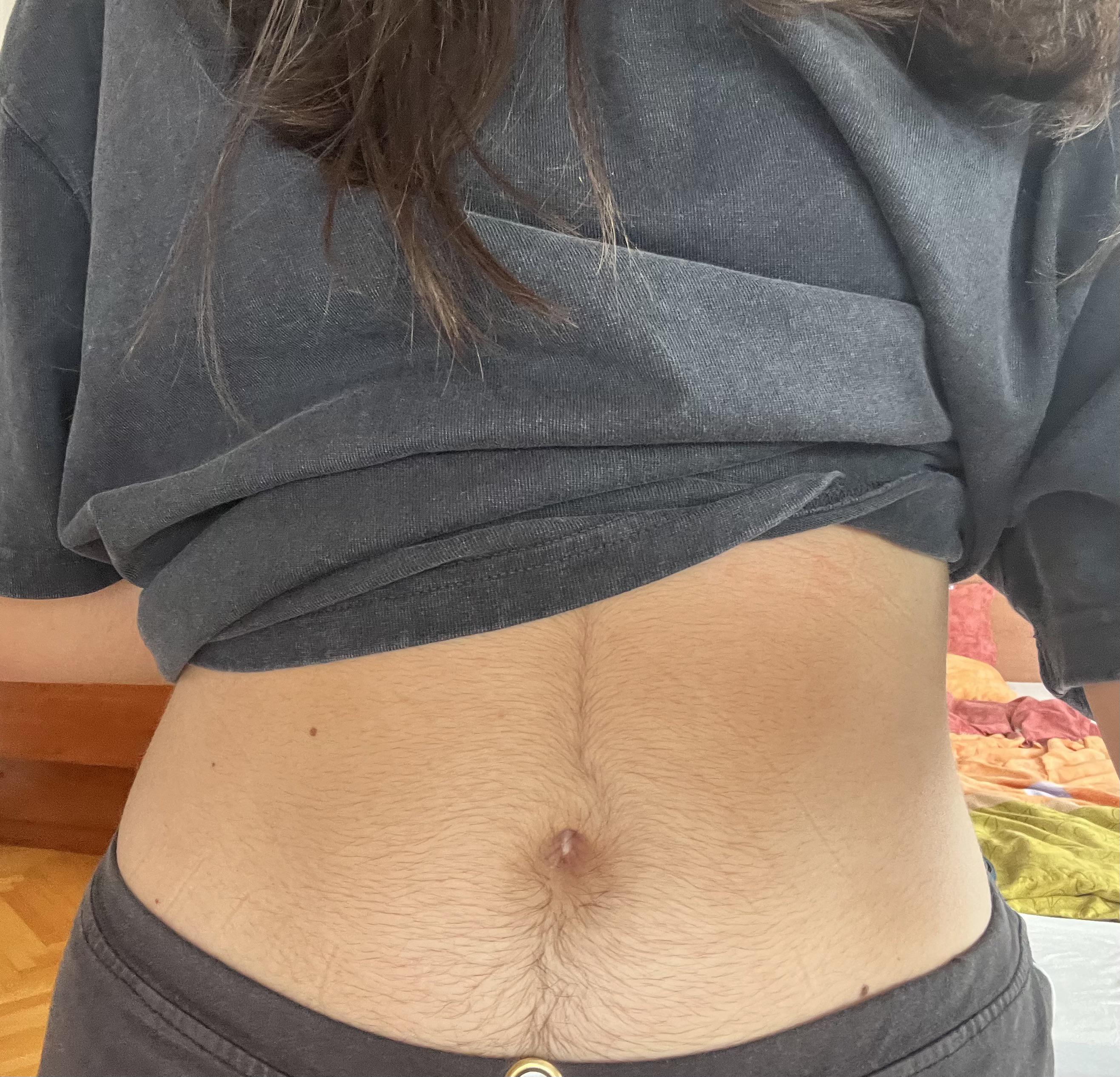 Stomach hair removal : rbeauty