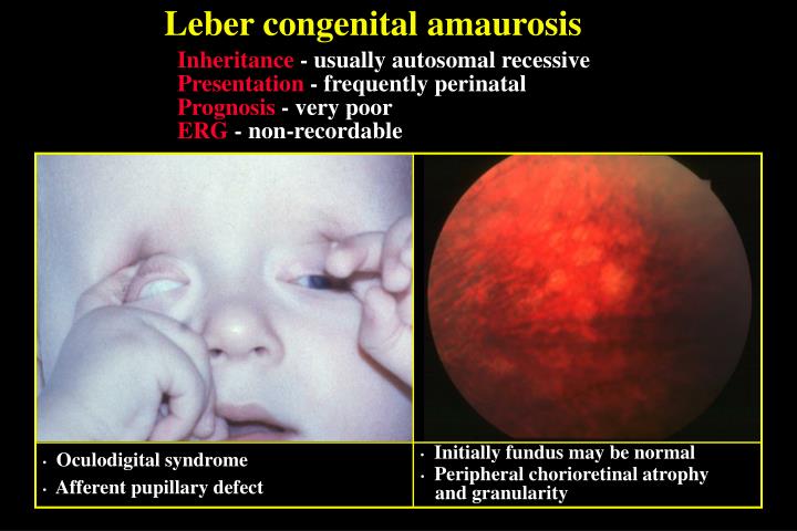 The rolling stones got it right. PPT - HEREDITARY RETINAL DYSTROPHIES PowerPoint