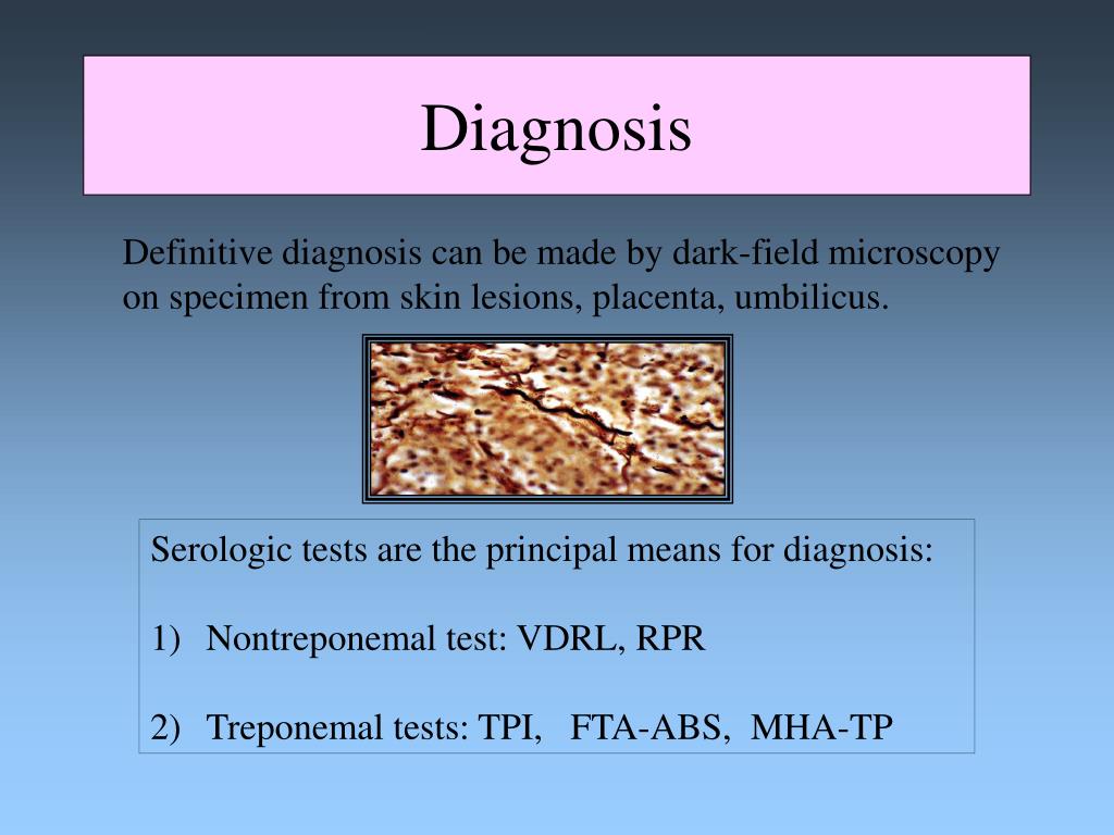 Understand how syphilis spreads, what you can do for prevention and how. PPT - CONGENITAL SYPHILIS PowerPoint Presentation, free