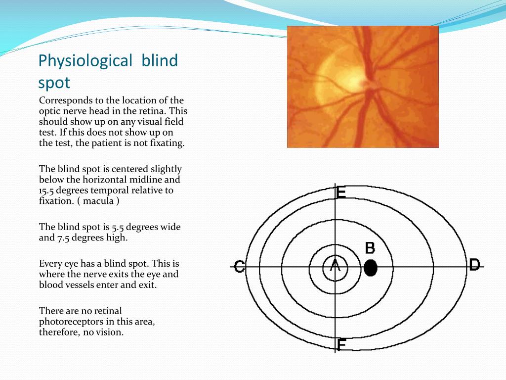 Reviews with decades of combined experience covering the latest news, reviewing. PPT - Visual Field Examinations PowerPoint Presentation