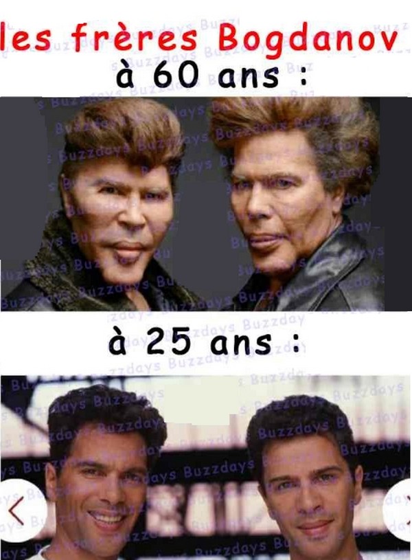Il y a 18 heures · grichka, l’un des frères bogdanoff, est mort à l’âge de 72 ans. Les Freres Bogdanov Avant Et Apres Image Lien