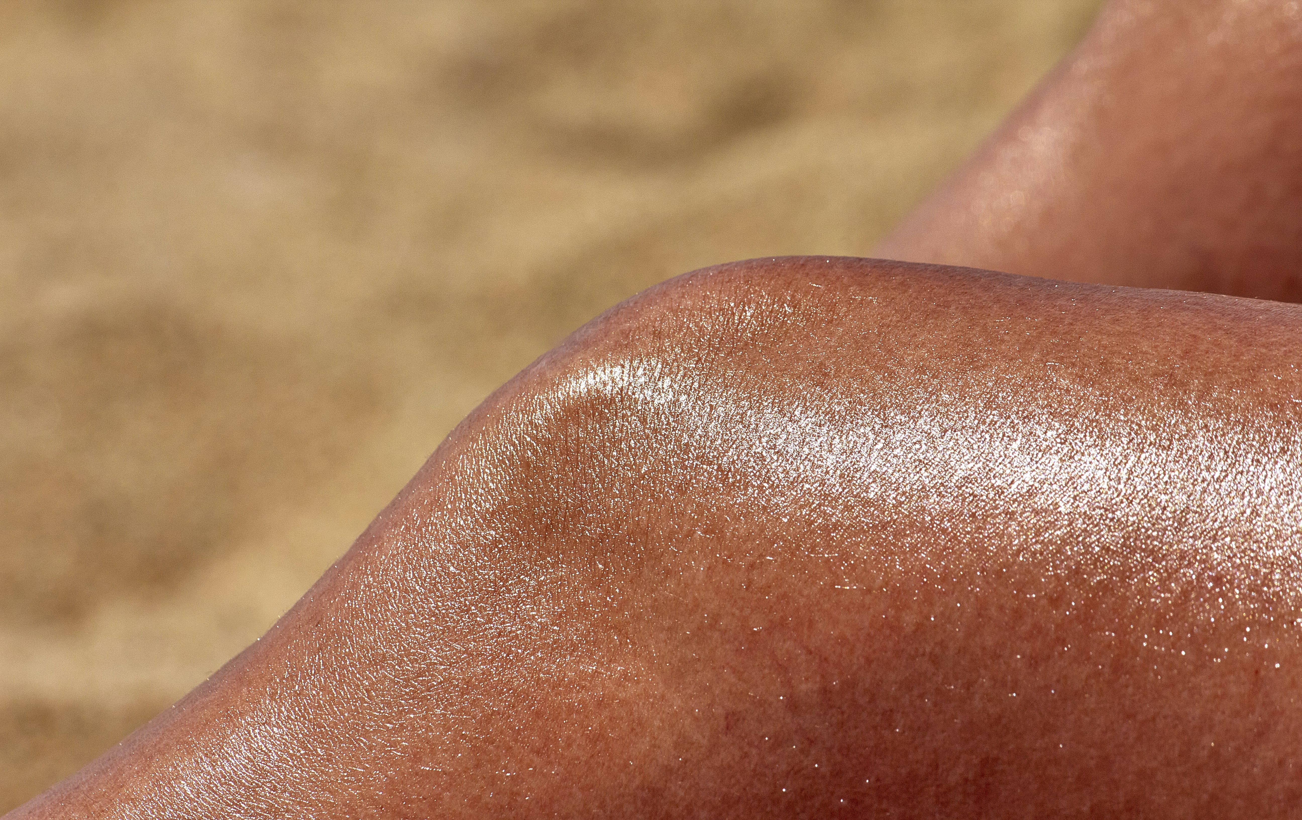 Sonnenbrand im Alltag: Die unterschätzten UV-Fallen