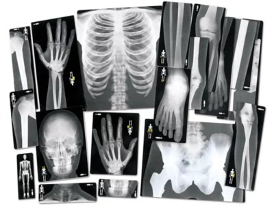 To revisit this article, select my account, then view saved stories. Human X Rays Set Of 18 At Lakeshore Learning