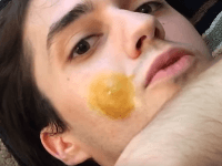 Bakerova cysta (tiež popliteálna cysta) je vačok, naplnený synoviálnou tekutinou v. Frajerka Ho Zbavila Cti Kedy To Uz Preboha Skonci Najodpornejsich Desat Minut Na Videu Topky Sk