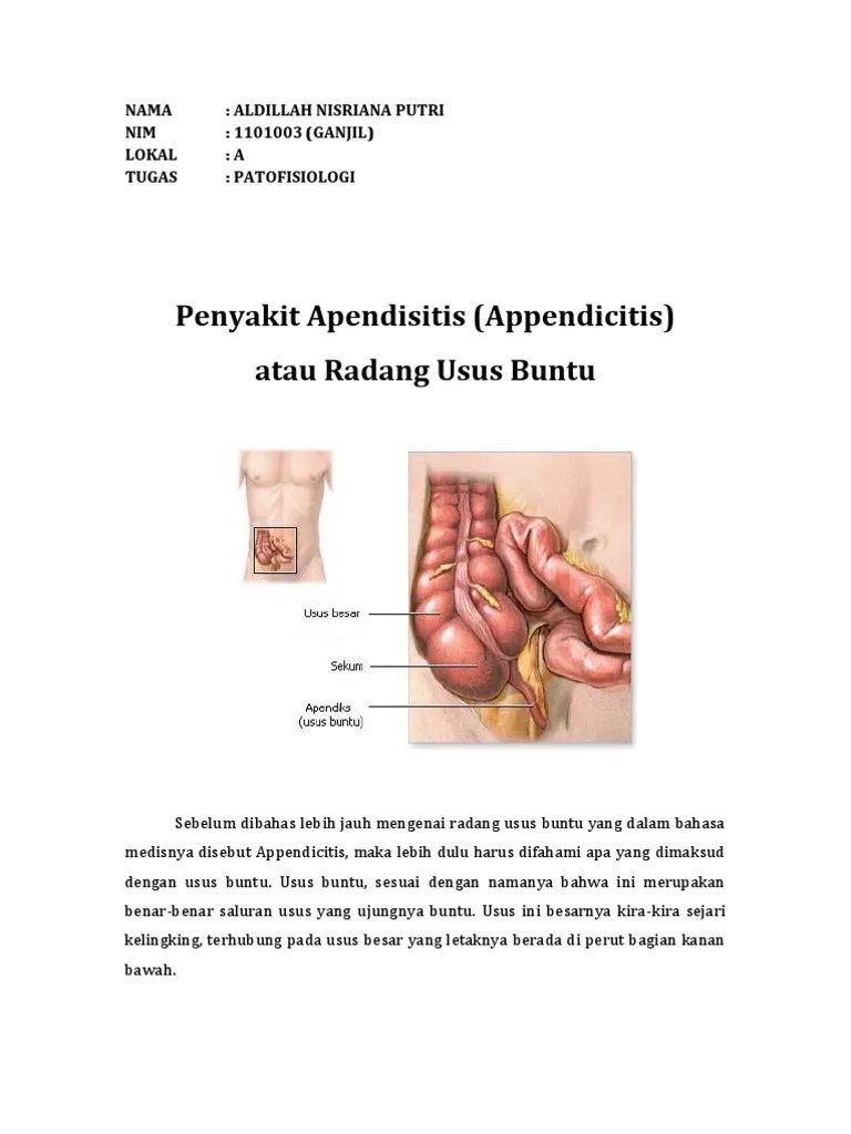 Penyakit Apendisitis | PDF