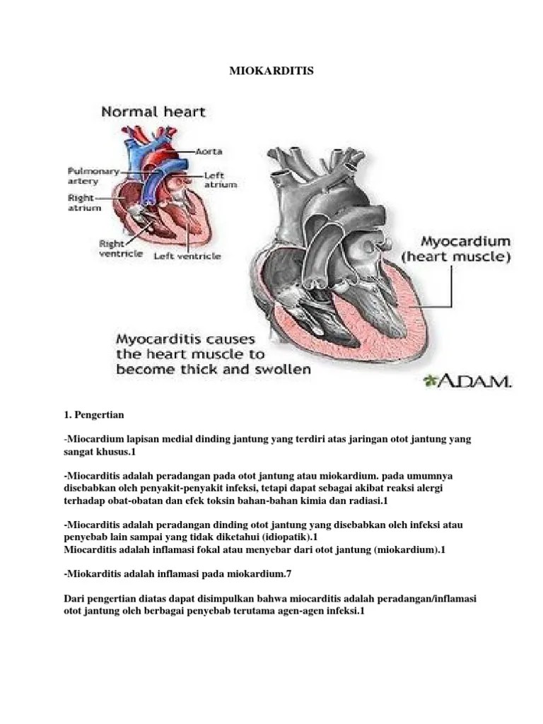 MIOKARDITIS | PDF