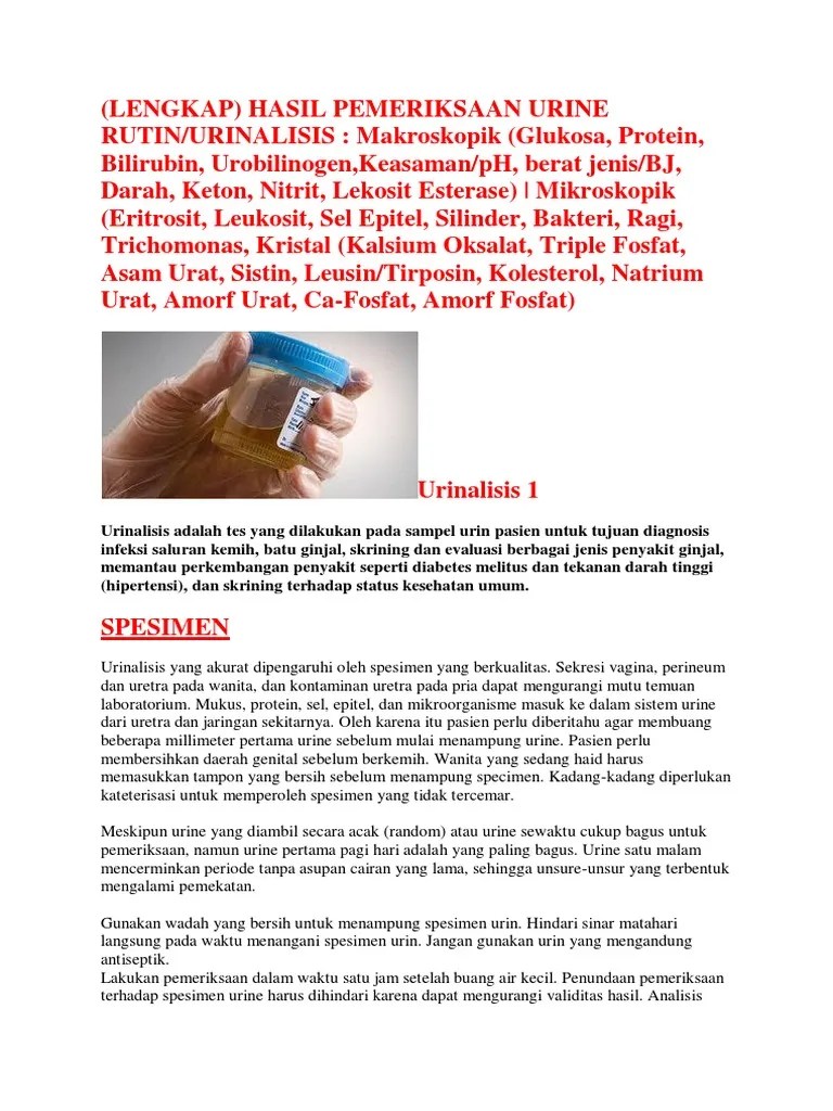What are you waiting for? Urin Lengkap Pdf