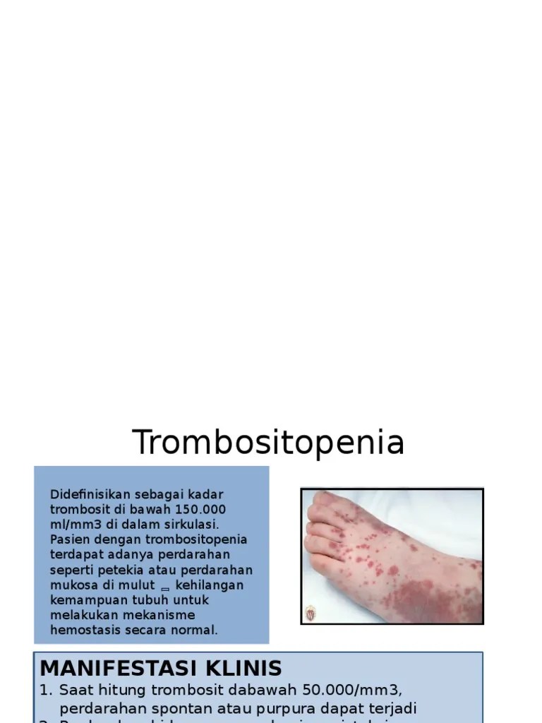TROMBOSITOPENIA | PDF