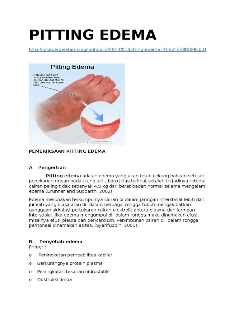 EDEMA Pitting Int | PDF