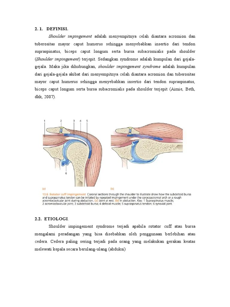 Impingement Sindrome | PDF