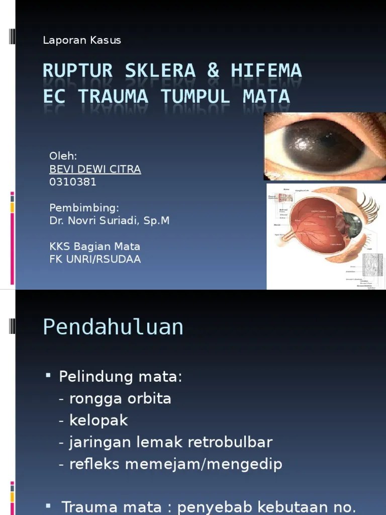 Case Ruptur Sklera &amp; Hifema | PDF