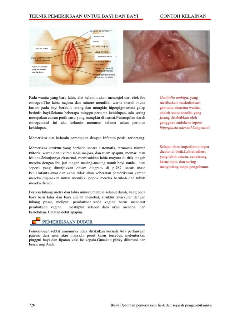 Teknik Pemeriksaan Untuk Bayi Dan Bayi Contoh Kelainan | PDF