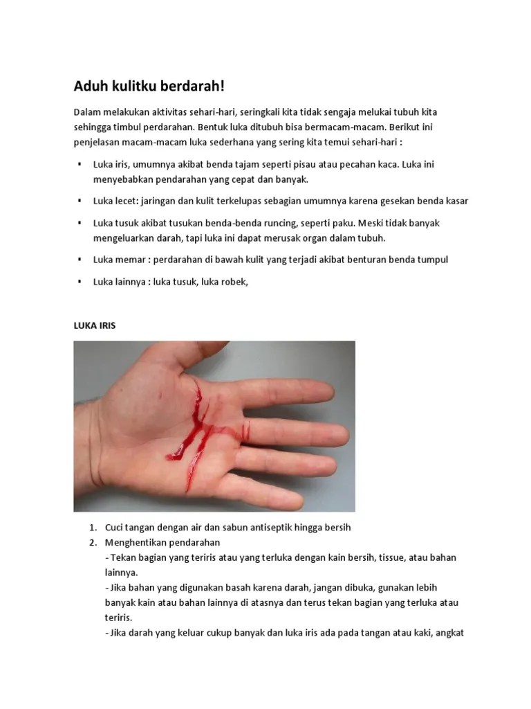 Petua merawat luka kecil secara tradisional. Penanganan Luka Sederhana