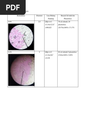 Plasmolisis Rhoeo Discolor | PDF