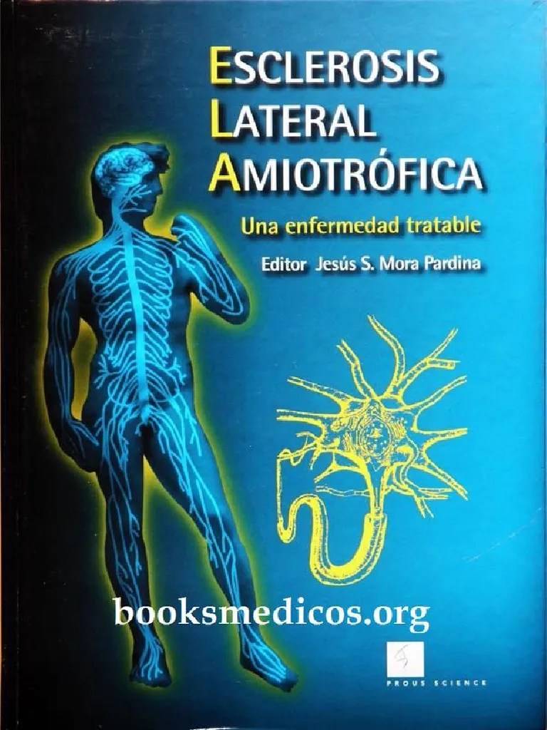 Amyotrophic lateral sclerosis is a neurodegenerative neuromuscular disease that results in the progressive loss of motor neurons that control voluntary muscles. Esclerosis Lateral Amiotrofica Una Enfermedad Tratable ...