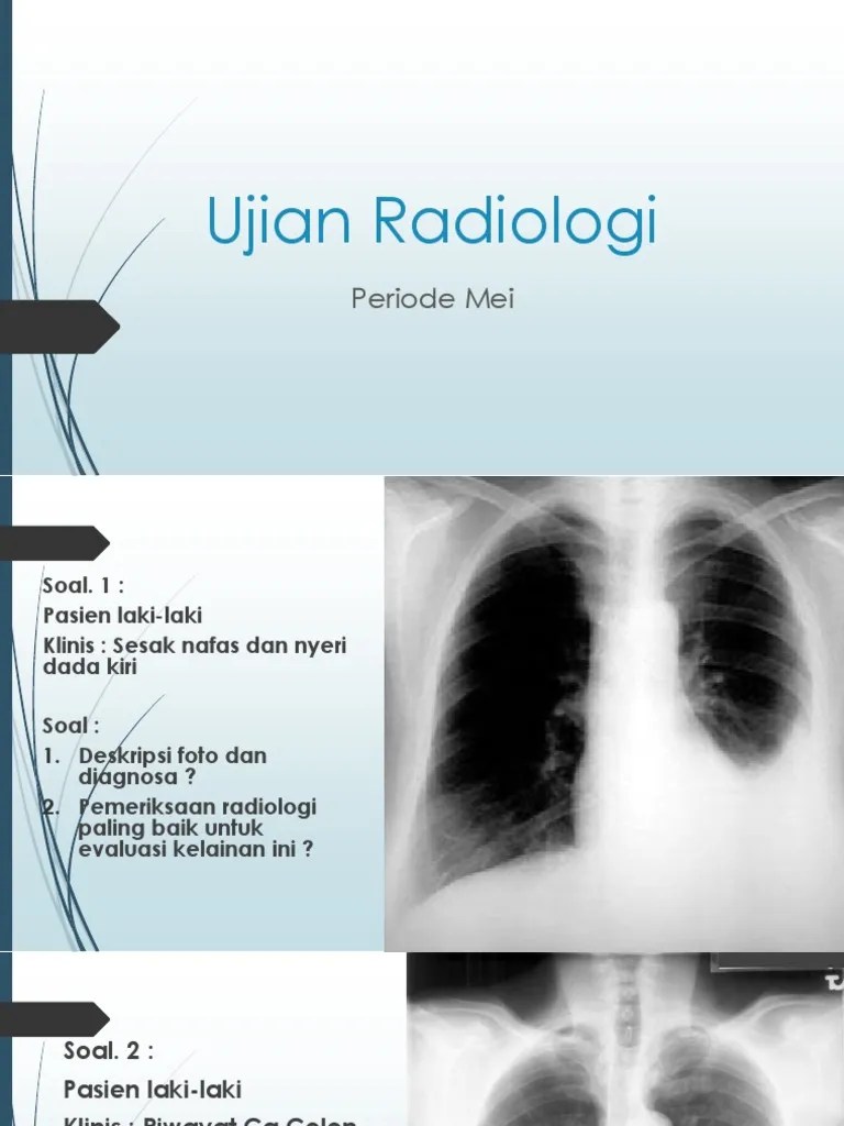 16.01.2017 · di ujian tertulis kedokteran, soal pilihan ganda yang jumlahnya mencapai 500 soal sekali ujian. Ujian Radiologi Periode Mei2017 Pdf