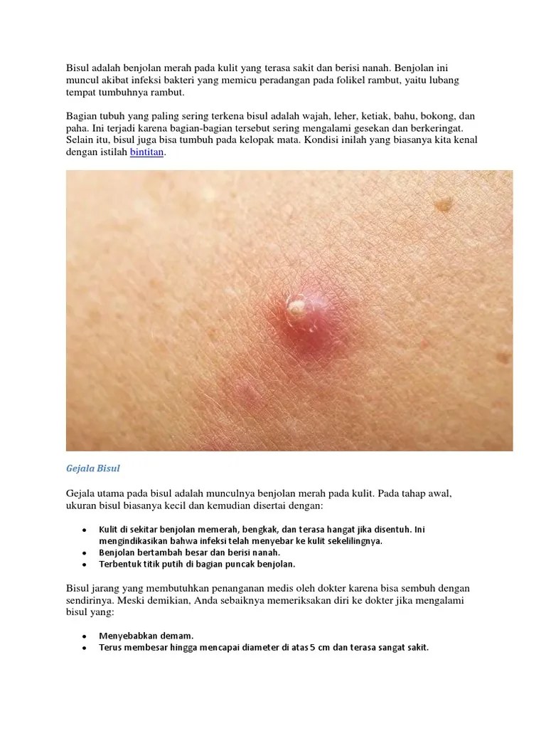 Penyakit Bisul | PDF