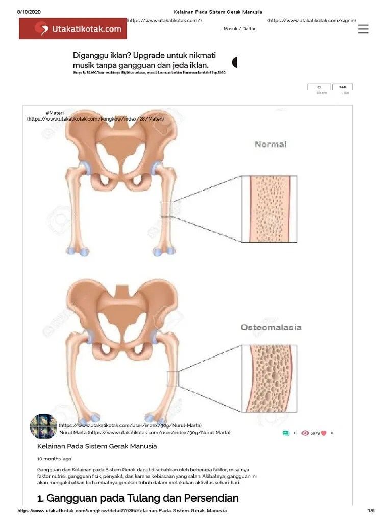 Kelainan Pada Sistem Gerak Manusia | PDF