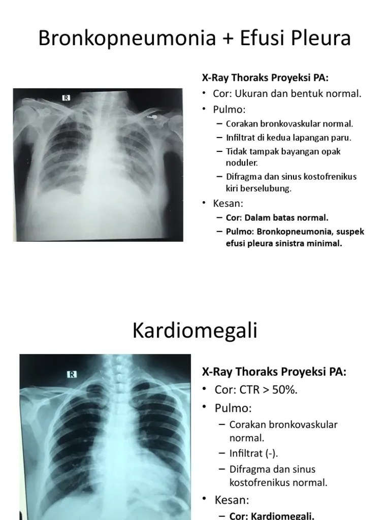 Belajar X-Ray 2 | PDF