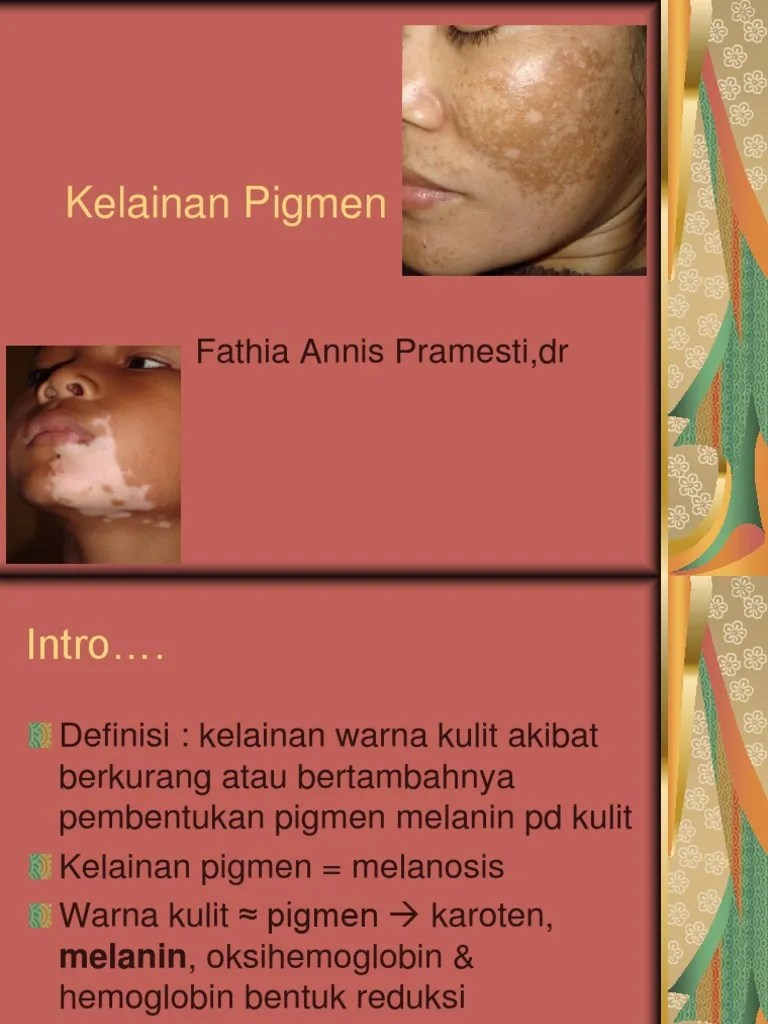 Kelainan Pigmen | PDF