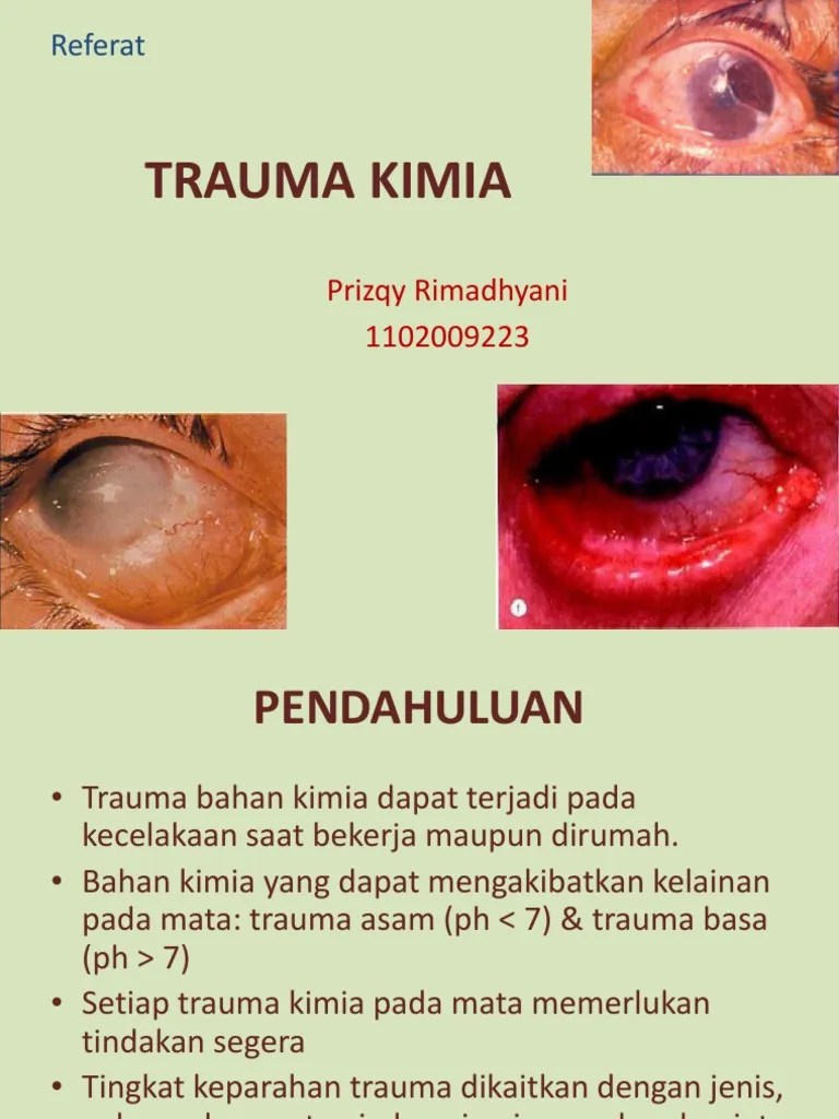 Trauma Kimia Mata | PDF