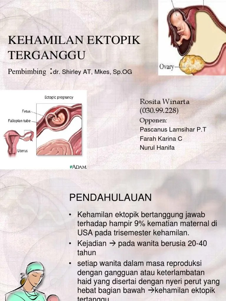 Kehamilan Ektopik Terganggu | PDF