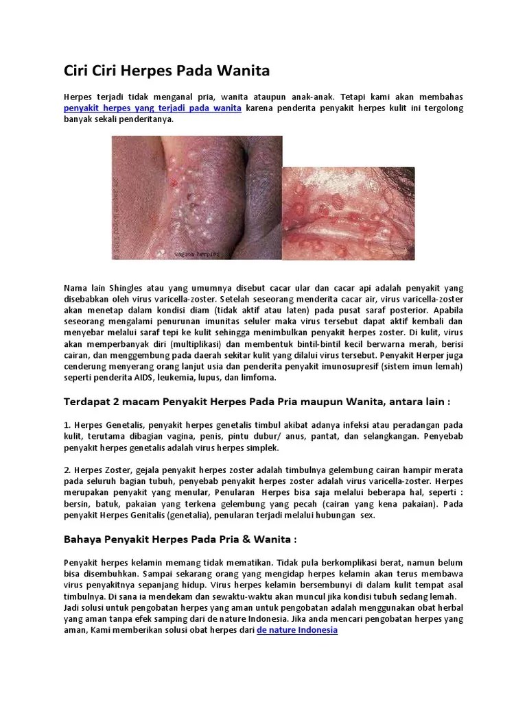 Ciri Ciri Penyakit Herpes Pada Anak - Ini Cirinya