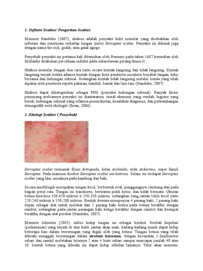Definisi Scabies | PDF