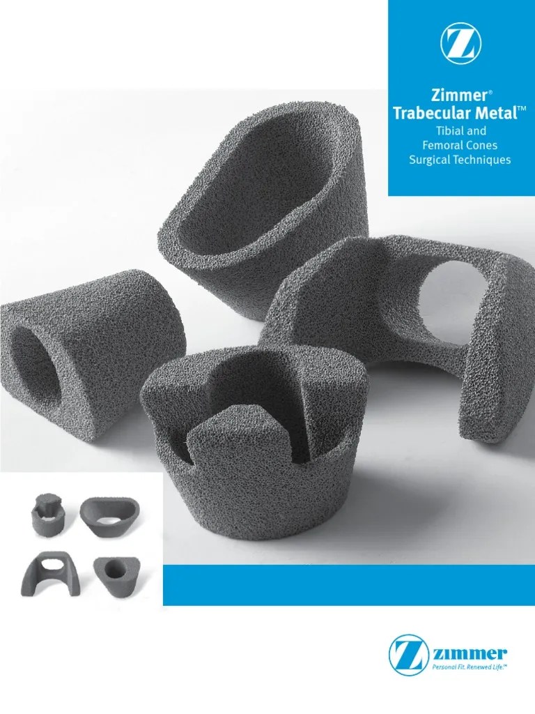 Delhi govt expedites plan to augment covid beds by 35k. Zimmer Trabecular Metal Tibial Cone Surgical Technique