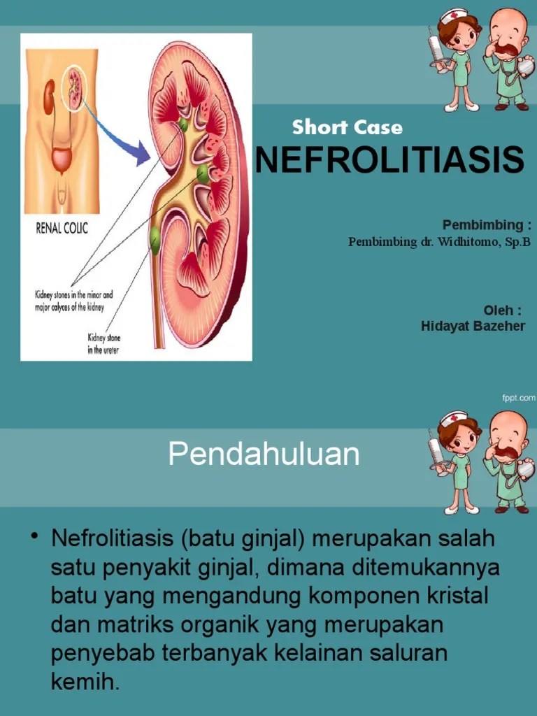 Nefrolitiasis | PDF