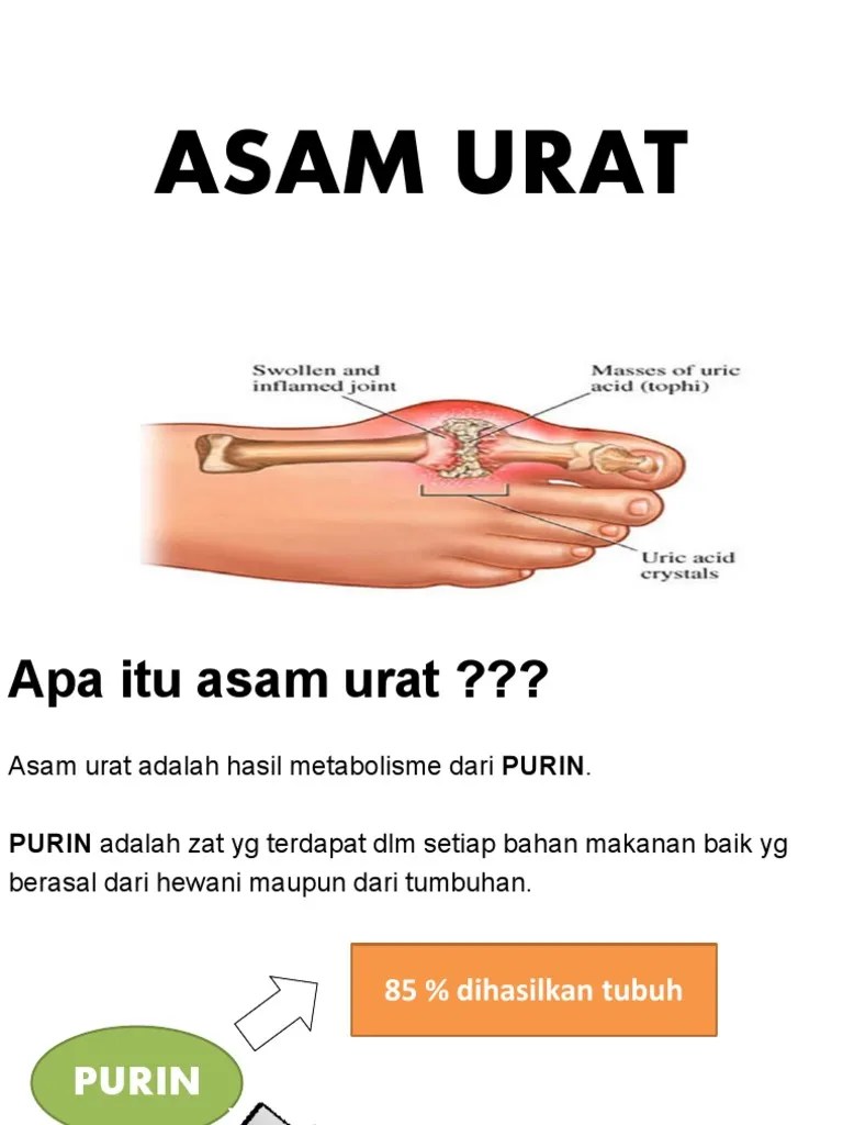 Asam Urat 2017 PDF | PDF