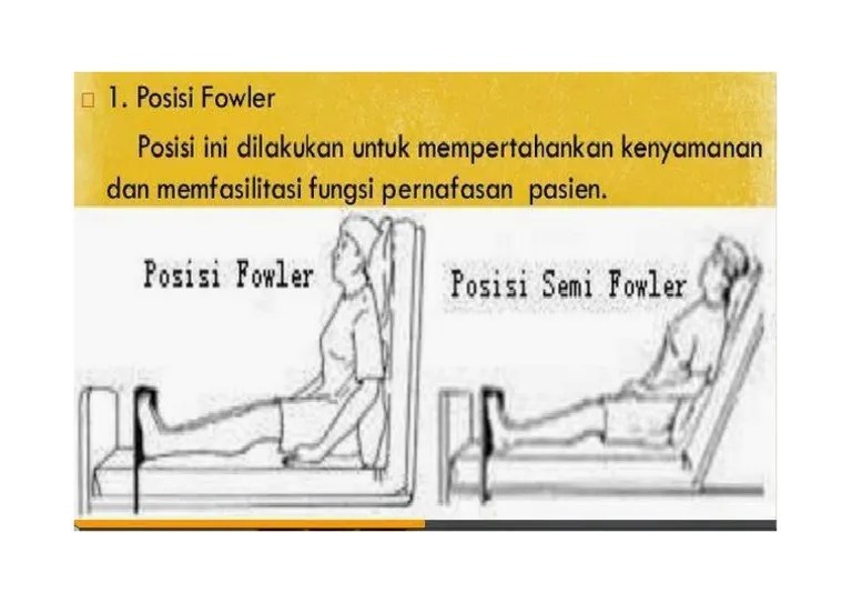 Posisi Semi Fowler | PDF