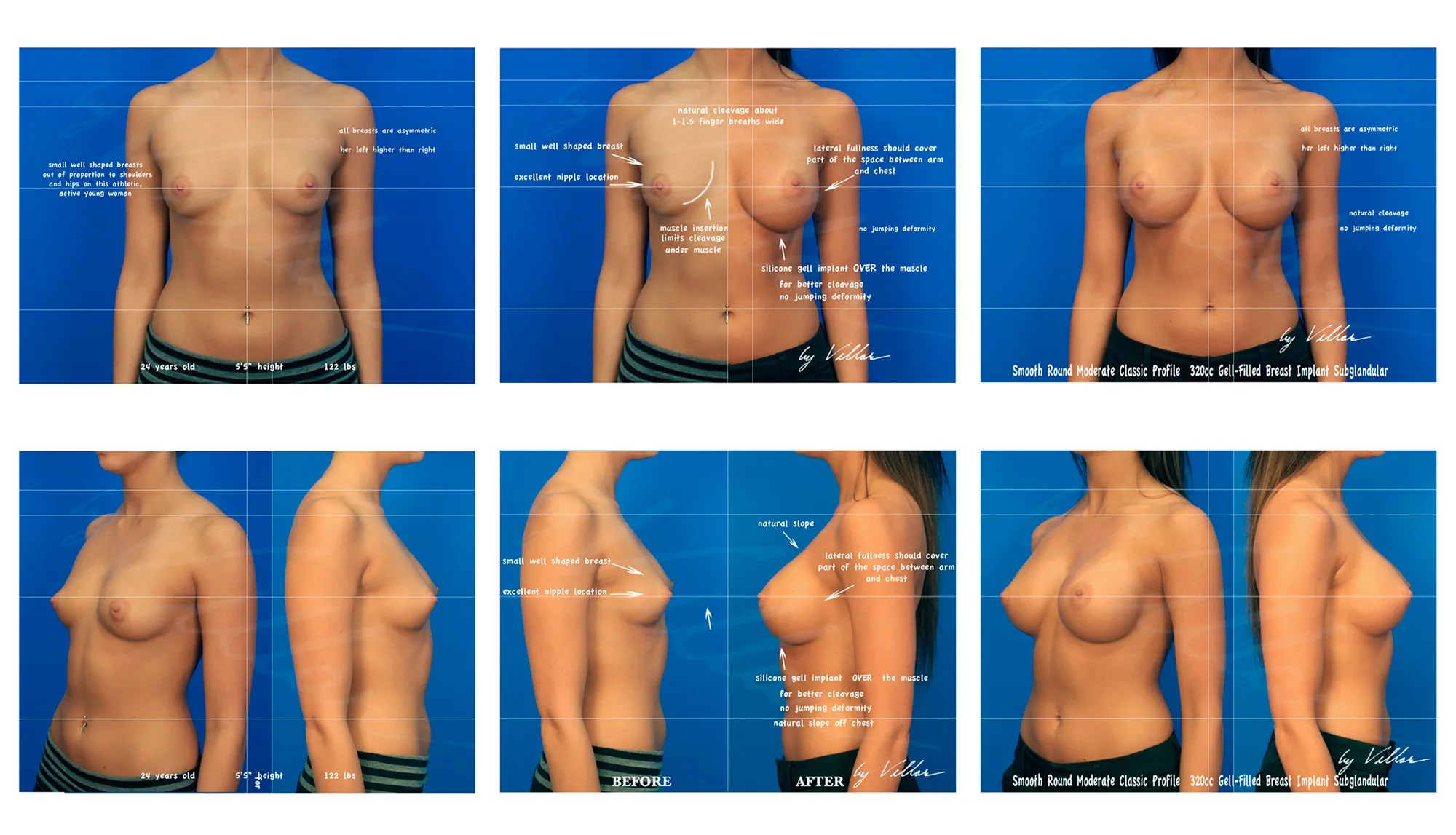 I've got naturally big boobs - my bikini haul in large barely covered the  girls but I don't mind showing them off | The US Sun