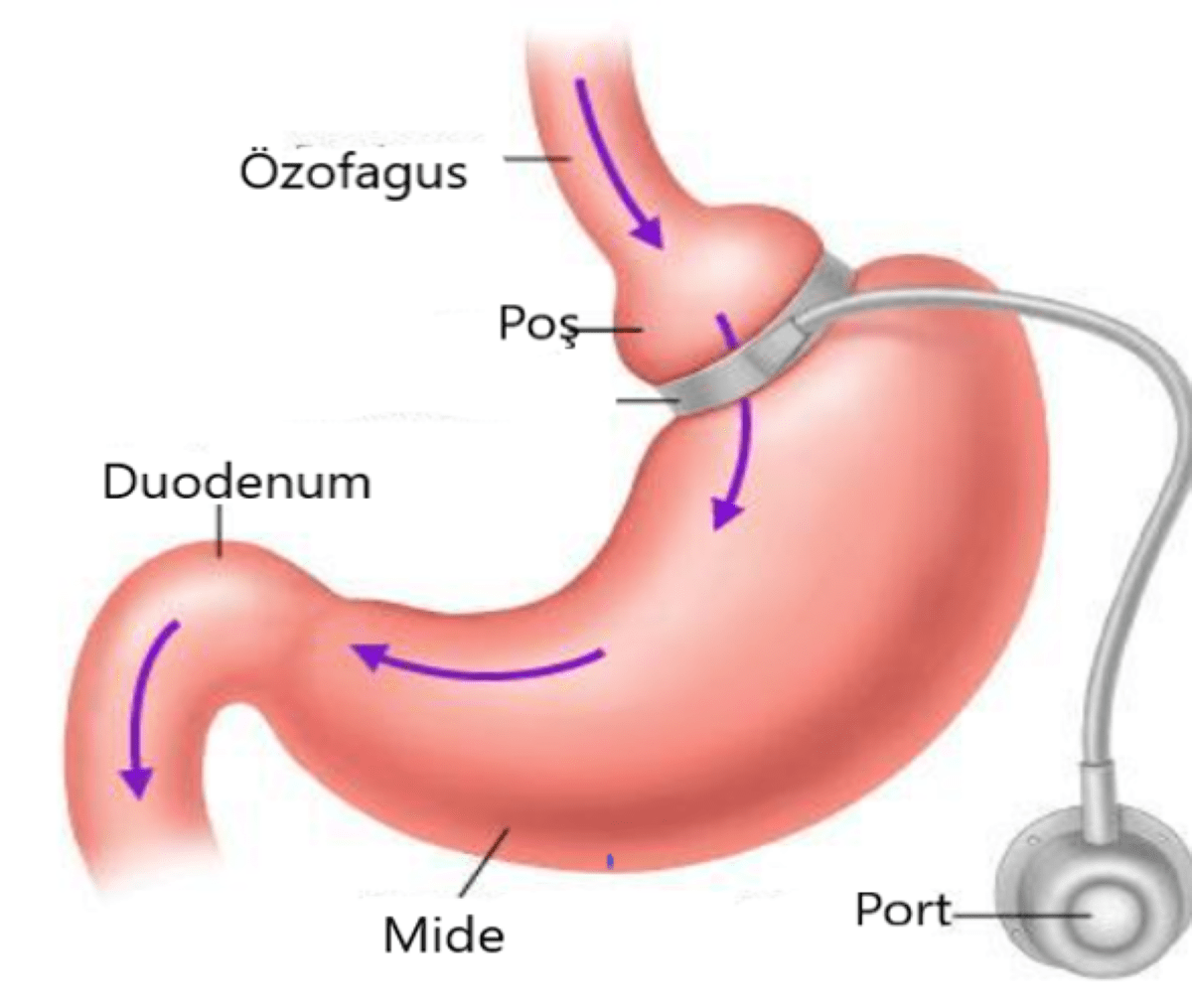 Tag Stomach Deformation