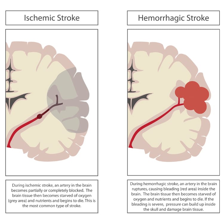 Infographics - Knowing Neurons