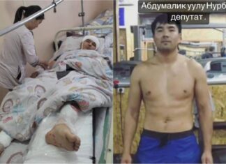 Кара-Суу: Айылдык кеңештин төрагасы тургунду бычактап, колу-бутун сындырып салганы айтылды