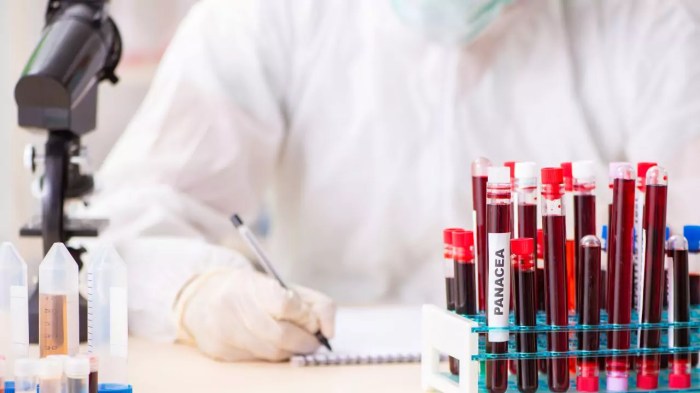 What Is The Cost Of Lab Tests Without Insurance In 2025? (Revealed) What Is The Cost Of Lab Tests Without Insurance In 2025? (Revealed)