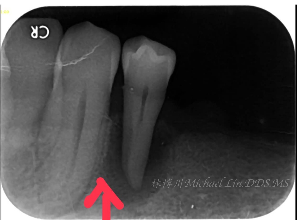 以鄰為壑 20230824