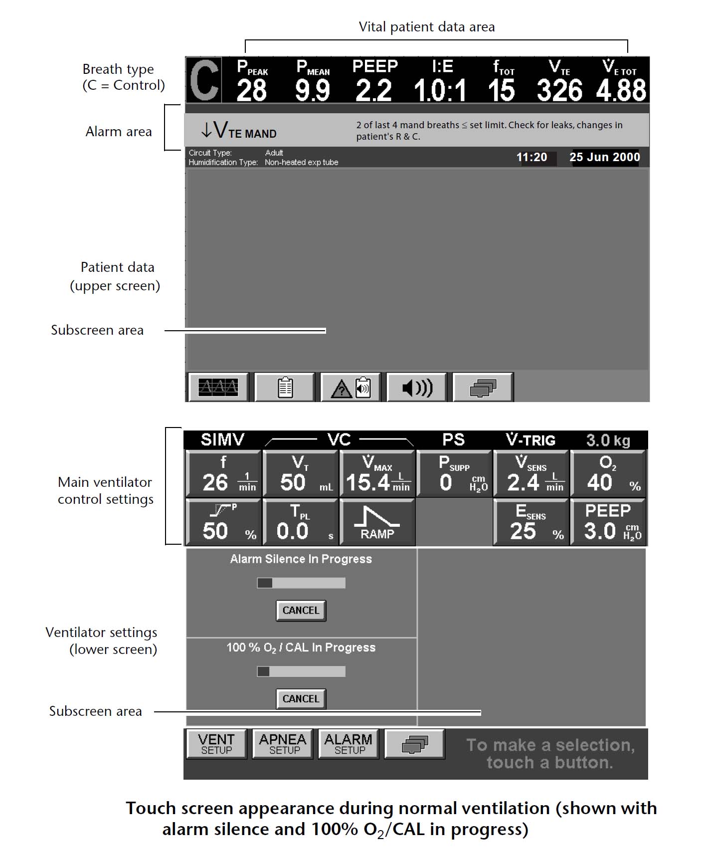 About this manual this manual provides information needed to service the puritan bennett 840 ventilator system. Puritan Bennett 840 760 740