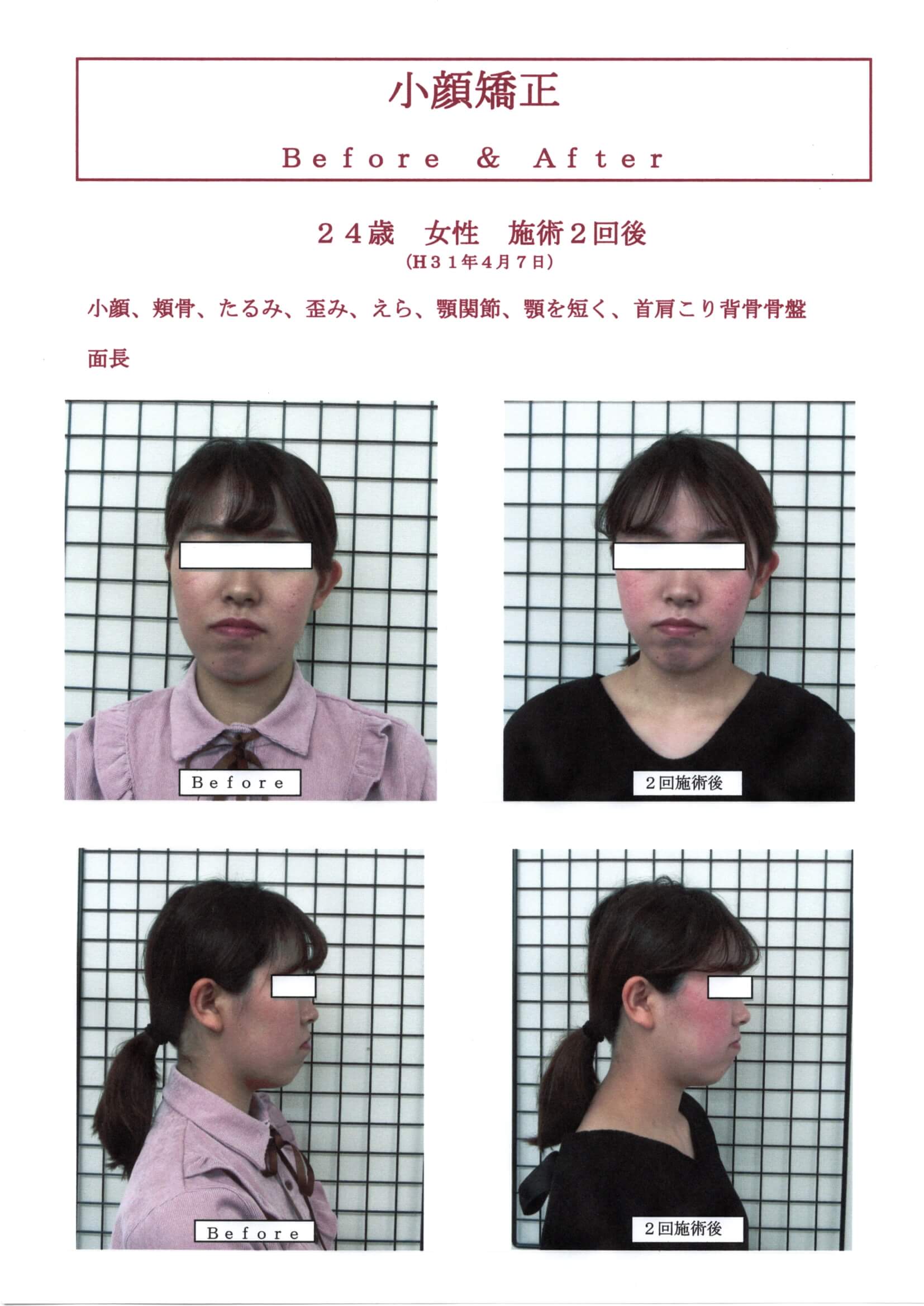 お顔の歪みでお悩みの方