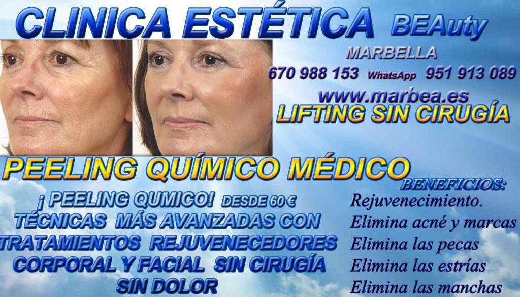 PEELING QUÍMICO MARBELLA Clinica Estética Marbella