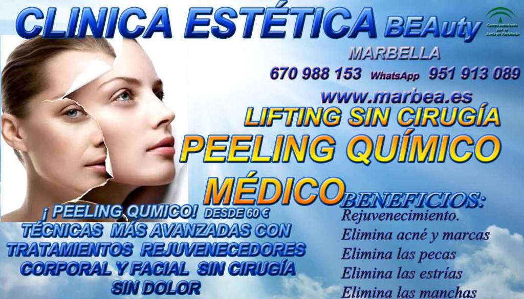 PEELING QUÍMICO MARBELLA Clinica Estética Marbella