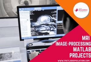 Matlab Medical Image Processing Projects (MRI)