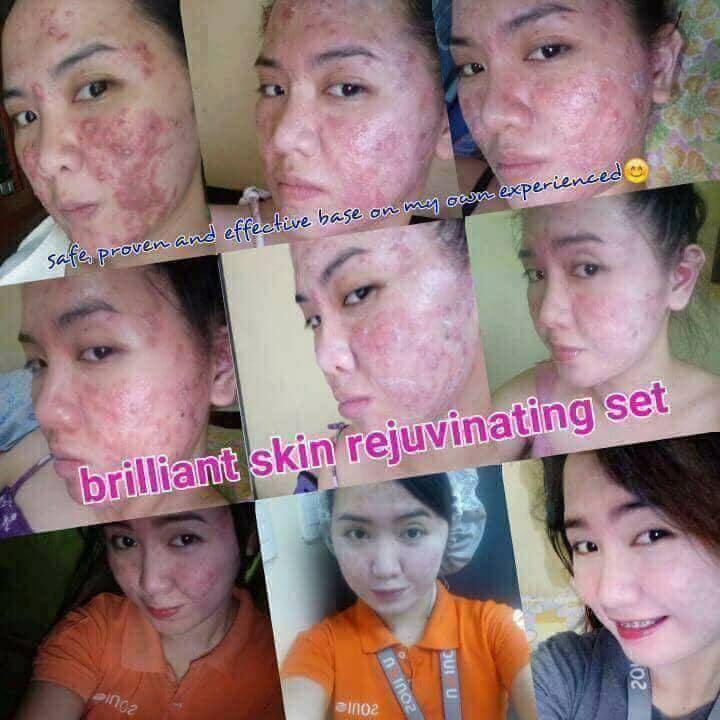 rejuvenating set brilliant skin
