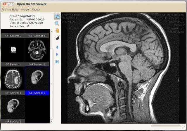 Tudor dicom viewer is a small, easy to use application specially designed to help you view and analyze dicom files with just a few clicks. Top 12 Free Open Source Dicom Viewers And Pacs Workstations For Macos