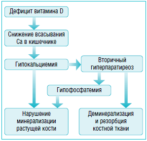 Статистические данные по рахиту. Рахит у детей – опасная патология костной системы. Гипохромная анемия, нарушение гомеостаза фосфора и кальция