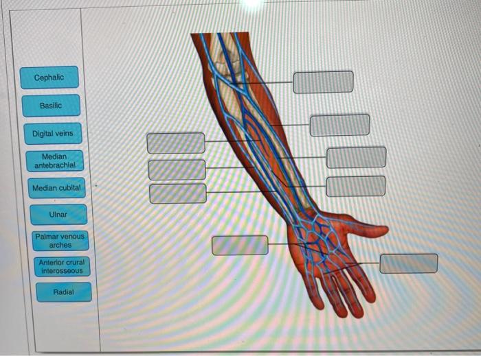 Treatment of cephalic arch stenosis (cas) with standard plain old balloon angioplasty (poba) in dysfunctional arteriovenous fistulas (avf), . Solved Cephalic Basilic Digital Veins Median Antebrachial Chegg Com
