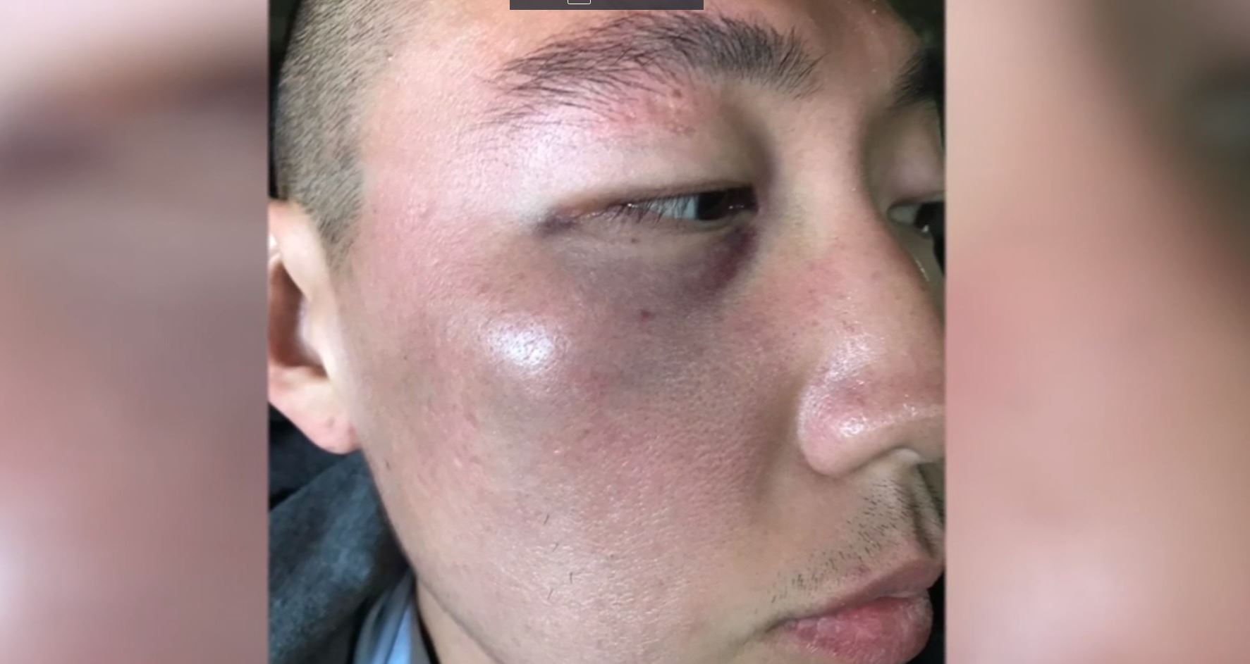 Attack on Asian American Air Force Veteran in Koreatown Being Treated as Hate Crime - Vimarsana News