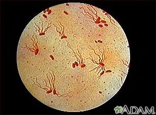Salmonella are a diverse group of bacteria. Salmonella Typhi Organism Medlineplus Medical Encyclopedia Image