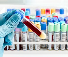 Laboratory clinic & general check up. Medlineplus Medical Tests